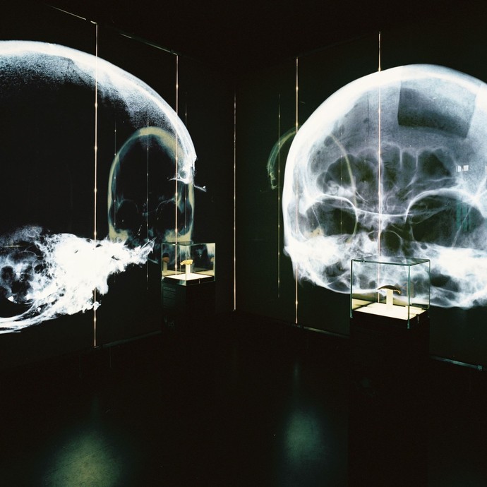 Ein dunkler Raum, an dessen Wänden Röntgenaufnahmen von zwei unterschiedlichen Schädeln zu sehen sind. Zwei Vitrinen stehen davor. (öffnet vergrößerte Bildansicht)